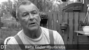 Ralle ender hautkrebs